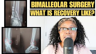 I BROKE MY ANKLE WHILE BOWLING My surgery recovery [upl. by Everick957]