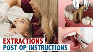 Extractions Post Op Instructions [upl. by Devaney]