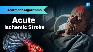 The Shocking Truth About Stroke Management No Doctor Tells You [upl. by Odnanref]