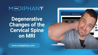 Degenerative Changes of the Cervical Spine on MRI [upl. by Oilalue793]