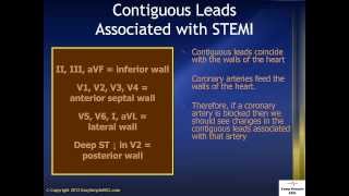 Contiguous Leads Associated with STEMI [upl. by Roon]