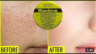 Nixoderm Cream Usage Reviews  Colorful World [upl. by Mccollum272]