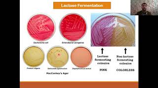 Classification of Enterobacteriaceae  Biochemical identification and complications [upl. by Adnawak617]