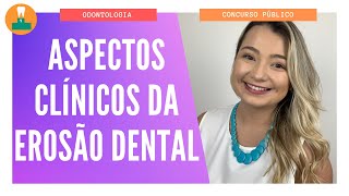 ASPECTOS CLÍNICOS DA EROSÃO DENTAL [upl. by Dallon91]