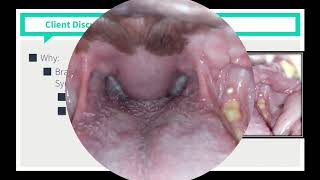 VICE Rounds  Brachycephalic Airway Syndrome See Description For How to Access More Videos [upl. by Acenes]