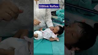 Neonatal Reflexes in Newborn baby newborn shortvideo [upl. by Rozele]