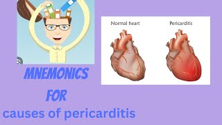 MNEMONICS for causes of pericarditis [upl. by Siari]