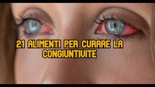 21 Alimenti per curare la congiuntivite [upl. by Arol]