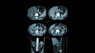 RADIOLOGY EXAM CASES [upl. by Rimat68]