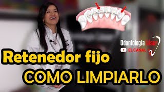 RETENEDOR FIJO  Como limpiarlo  Odontología Láser [upl. by Donatelli]