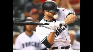 WORST HITS TO THE HEAD MLB [upl. by Wieche]