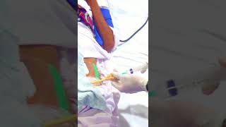 Urinary catheter removal male how to remove Foley catheter shorts youtubeshorts catheter [upl. by Kopple495]