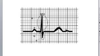 Basic Cardiology Cardiac Cycle Action Potential and the QRS Complex [upl. by Laemaj771]