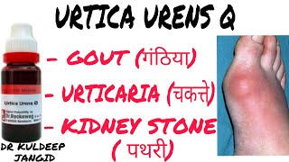 Uses of Urtica urens Q । Best homeopathy medicine of gout । best medicine for kidney stone । गंठिया [upl. by Llewol]