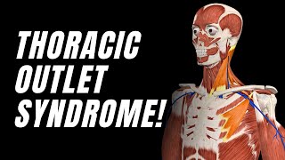 Thoracic Outlet Syndrome Anatomy You NEED To Know This [upl. by Gwendolyn]