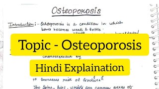 Osteoporosis  Clinical Orthopaedics  Hindi Explaination  Handwritten notes [upl. by Airat581]