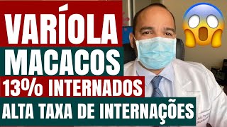 VARÍOLA DOS MACACOS COM ALTA TAXA DE INTERNAÇÃO POR SINTOMAS LIMITANTES 13 de INTERNAÇÕES [upl. by Akima811]