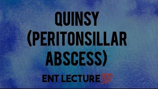 Quinsy lecture  Peritonsillar abcess  Ent lecture [upl. by Ahrat570]