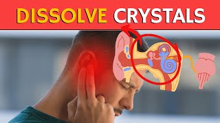 How to DISSOLVE Crystals in the Inner Ear and Get Rid of Vertigo [upl. by Magulac]