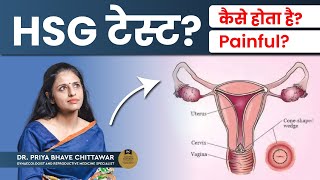 HSG Hysterosalpingography test क्या है और कब किया जाता है  HSG Test in Hindi  Dr Priya Bhave [upl. by Asiek]