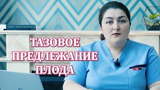 Тазовое Предлежание Плода  Мифы и Факты [upl. by Milewski]