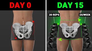 The Best Weight Training Exercises To Fix Lateral Pelvic Tilt asymmetrical hips [upl. by Mcwilliams]