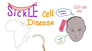 Sickle Cell Disease “Part 1” Intro [upl. by Vikky489]