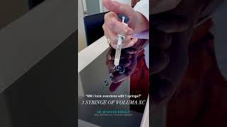 1 Syringe of Juvederm Voluma XC [upl. by Hayikat44]