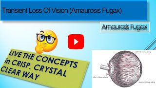 Transient Loss Of Vision Amaurosis Fugax [upl. by Rosette]