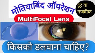 MultiFocal Lens किसको डलवाना चाहिए।Cataract।multifocal । [upl. by Ferrel776]