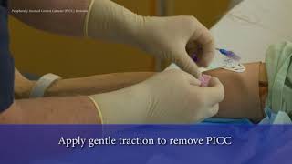 PICC Line Removal [upl. by Nylarej]