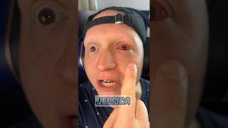 When you have pink eye comedy funny gamer relatable skit [upl. by Winshell]