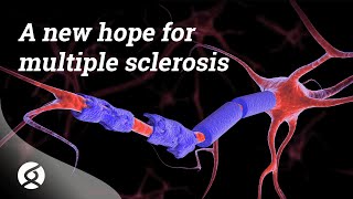 A new hope for multiple sclerosis  Public seminar [upl. by Elleiad]