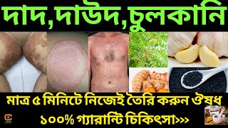 দাদ চুলকানি দূর করার চিকিৎসা।দাদের প্রাকৃতিক চিকিৎসা🥶ringworm।daraj skin problem solution।dader osud [upl. by Blanc]