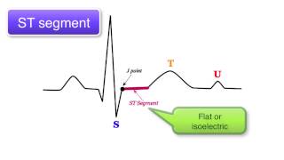 ECG Basics 910  ST interval T wave and U wave [upl. by Sullecram]