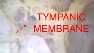 TYMPANIC MEMBRANE [upl. by Defant900]