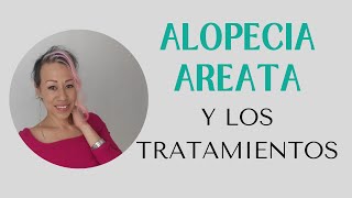 ALOPECIA AREATA y los tratamientos [upl. by Vincent]