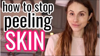 How to STOP PEELING SKIN Dr Dray [upl. by Llevel]