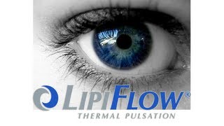 Lipiflow Thermal Pulsation  Dry Eye Treatment [upl. by Eilak]