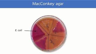 MacConkey agar หลักการ วิธีการอ่านผล  HCU [upl. by Humpage762]