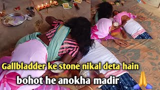 Gollbladder ke stone nikal rahahain Anokha mandir [upl. by Ermey2]