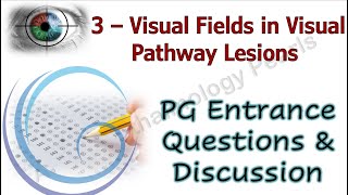 Visual Fields in Visual Pathway Lesions PG Entrance Questions amp Discussion 3 [upl. by Pacificia]