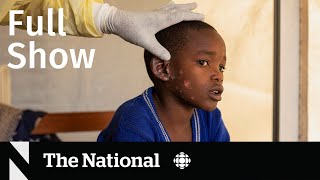 CBC News The National  Mpox global health emergency [upl. by Rovert]