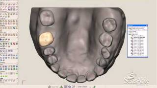 SensAble FreeForm Software Orthodontia Aligners  Dental Braces [upl. by Emina]