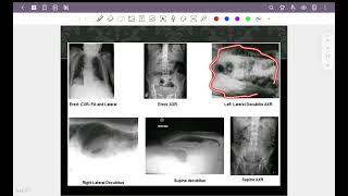 Abdominal radiograph part 1  How to approach to abdominal xray amp pneumoperitoneum [upl. by Lewse192]