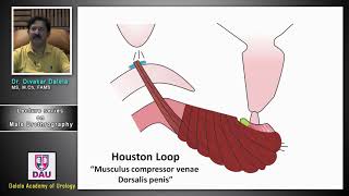 Lecture 4 on male urethrography [upl. by Trisha]