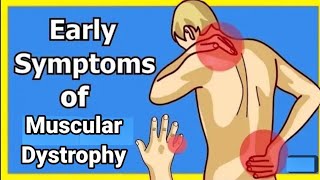 Muscular dystrophy ki pehchan kainse karein  Sure symptoms of muscular dystrophy [upl. by Kalina]