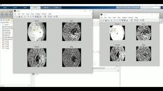 Retina Image Segmentation With Wavelet Transform From Scratch Matlab Code [upl. by Ullund507]