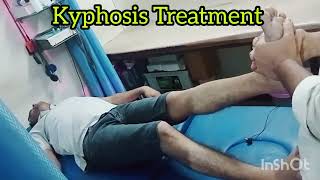 kyphosis Treatment  Chiropractor Treatment  DrRavi kumar  7678369727 [upl. by Kcirddec]