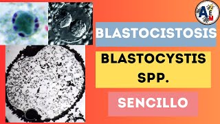 BLASTOCISTOSIS  BLASTOCYSTIS SPP POSIBLE CAUSA DEL INTESTINO IRRITABLE [upl. by Guthrey]